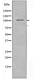 ARHGAP11A Antibody