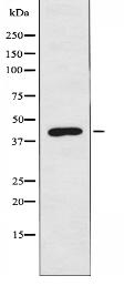 ARRDC3 Antibody