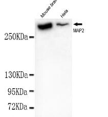 MAP2(N-term) Mouse mAb