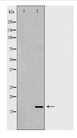 ANG Antibody