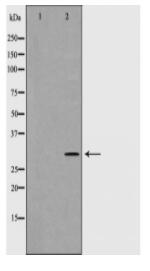 HLA-DPB1 Antibody
