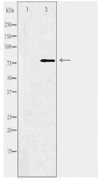 ABCB10 Antibody
