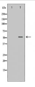 DES Antibody