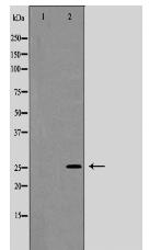 Connexin 26 Antibody