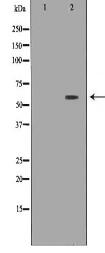 SLC5A1 Antibody