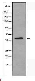 SLC10A7 Antibody