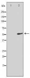 NK3R Antibody
