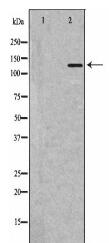 PLCB1 Antibody