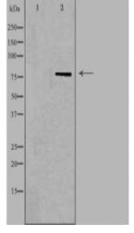 NDUFS1 Antibody