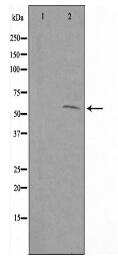 SHC2 Antibody