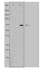 PRPF39 Antibody