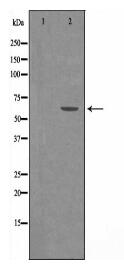 YTHDF1 Antibody