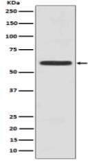 Cytokeratin 5 (C-term) Antibody