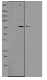 NCBP1 Antibody