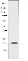 SF3B14 Antibody