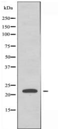 MGMT Antibody