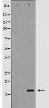 Interleukin 2 Antibody