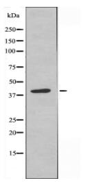 MOS Antibody
