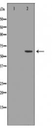 NEFL Antibody
