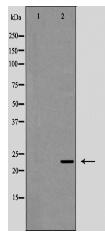 Interleukin 12A Antibody