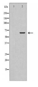 TCTN3 Antibody