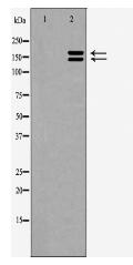 FosB Antibody