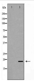 UBE2C Antibody