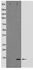 Trefoil factor 2(TFF2) Antibody