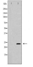 TIMP3 Antibody