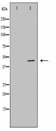 SPHK1 Antibody