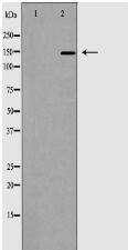ACE1 Antibody