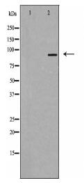 RBM5 Antibody