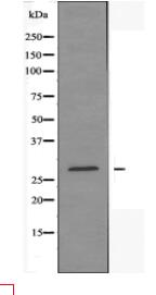 LDLRAD2 Antibody
