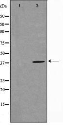 Gastrin Antibody