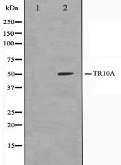 TR10A Antibody