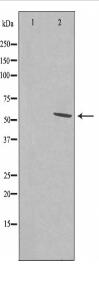 SFRS11 Antibody