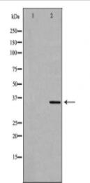 MNAT1 Antibody