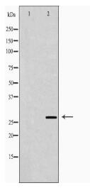 IGFBP1 Antibody