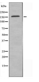MYOM2 Antibody