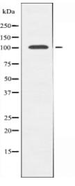 N4BP1 Antibody