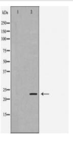 LCN2 Antibody