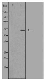 SLC6A8 Antibody