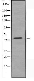 ZC3H8 Antibody