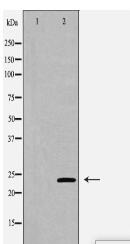 VHL Antibody