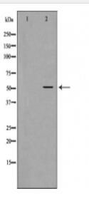 NAMPT Antibody