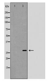 SETD2 Antibody