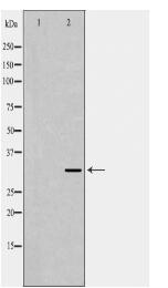 TPM3 Antibody