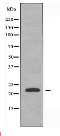 TUSC5 Antibody