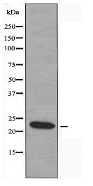 Recoverin Antibody