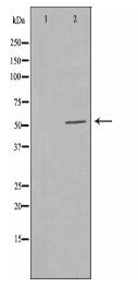 PFKFB1/4 Antibody